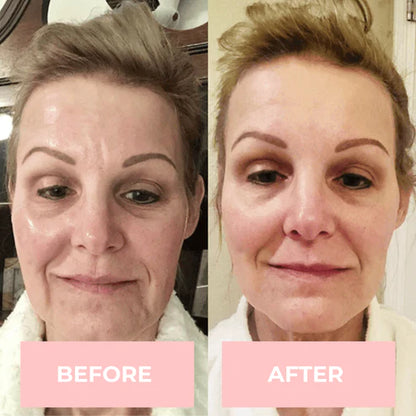 LumeTone Golden Restore